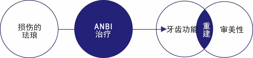 ANBI